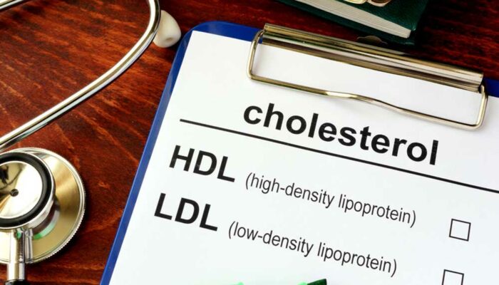 Tips to Lower Cholesterol Levels Naturally