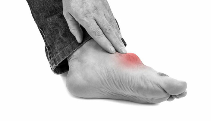 Top triggers for gout foot pain