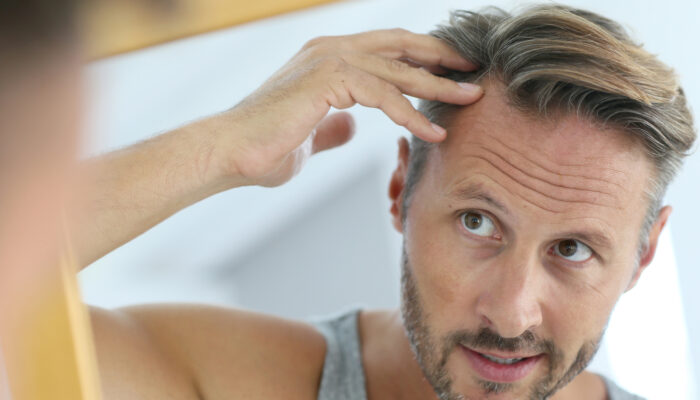 Treatment Options for Hair Loss