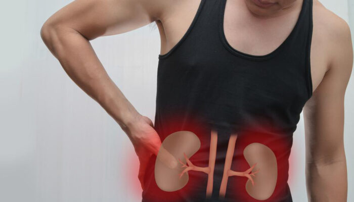 Treatment options for various causes of kidney pain