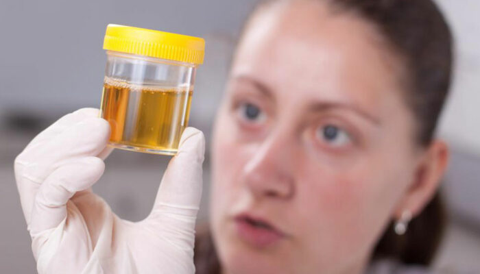 Types of urine colors and what they indicate