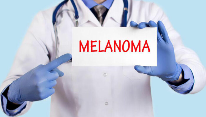 Understanding metastatic malignant melanoma