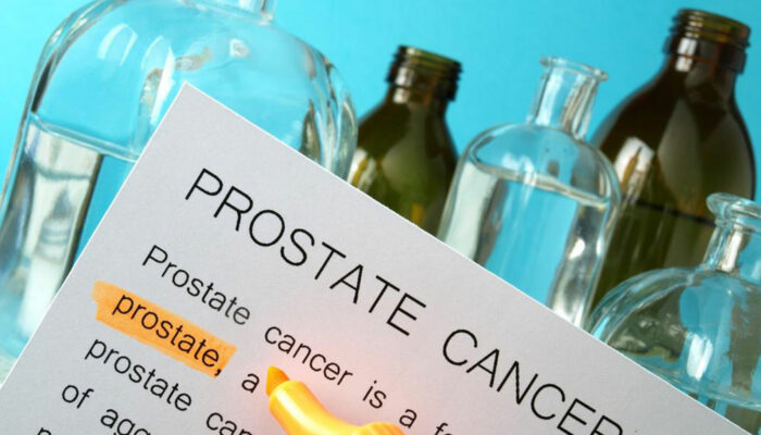 Understanding metastatic prostate cancer