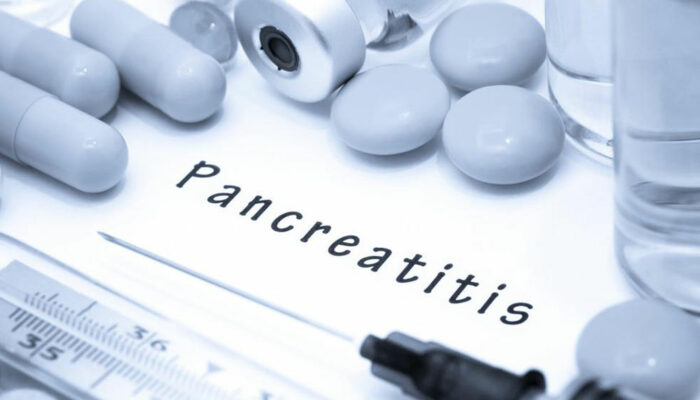 Understanding the early signs and types of pancreatitis