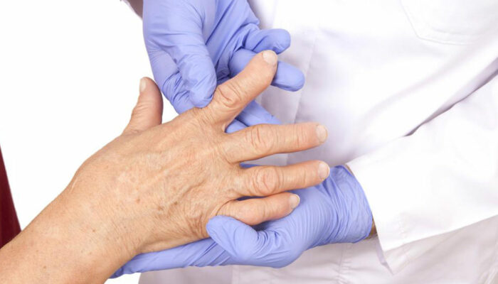 Understanding the various types of arthritis