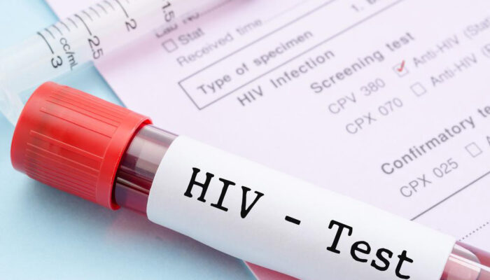 What are the early signs and symptoms of HIV infection?