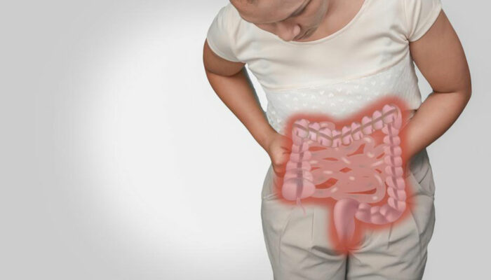 What are the factors that cause irritable bowel syndrome?