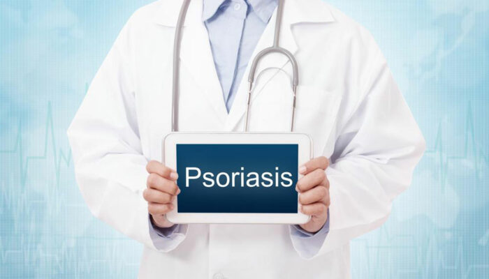 What are the possible plaque psoriasis treatments?