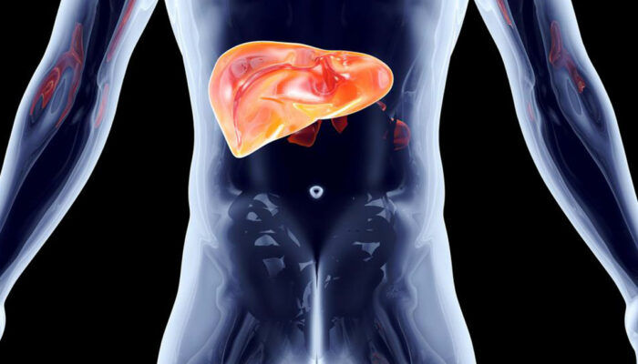 What does stage 4 Hepatitis C mean for your liver