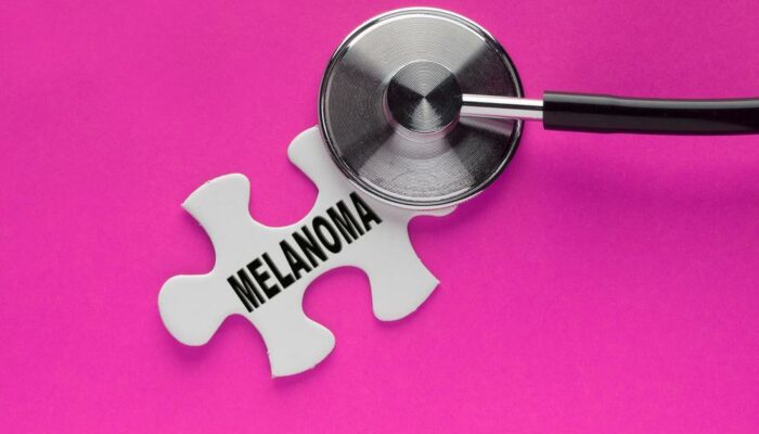 What is Melanoma Skin Cancer