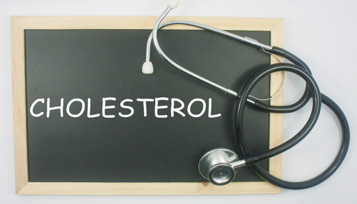 What is cholesterol