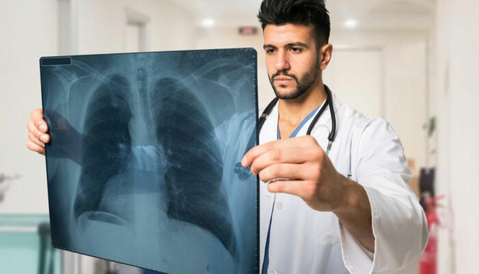 4 Common Treatment Options for Lung Cancer