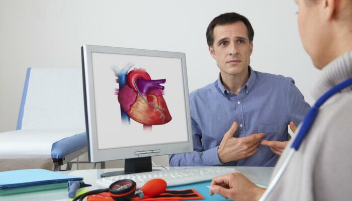 4 Things To Understand Before Undertaking Atrial Fibrillation Treatment