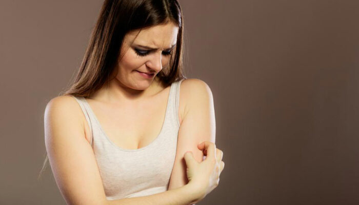 4 Types of Skin Rashes You Should Know Of