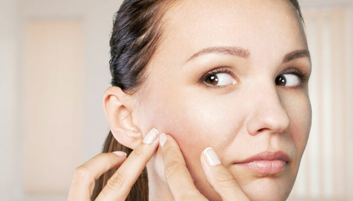 4 common skin problems and ways to deal with them