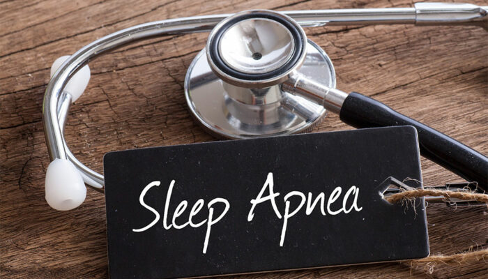 4 ways to manage sleep apnea