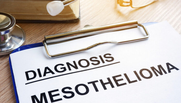 5 Treatment Options for Mesothelioma