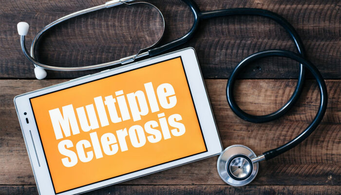 5 common treatments for multiple sclerosis