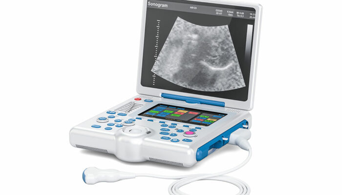 5 best portable ultrasound machines