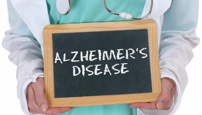 5 things to know about Alzheimer&#8217;s disease