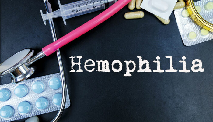 5 tips to manage hemophilia