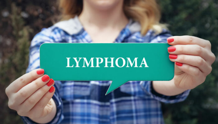 6 Factors That Contribute to the Risk of Developing Lymphoma