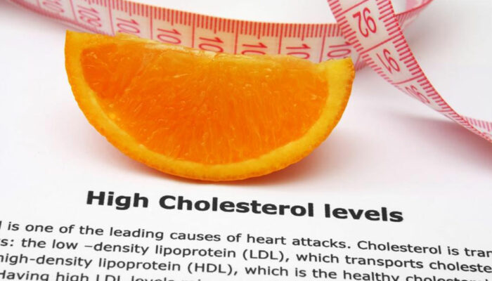 6 Self-Management Tips for High Cholesterol Treatment