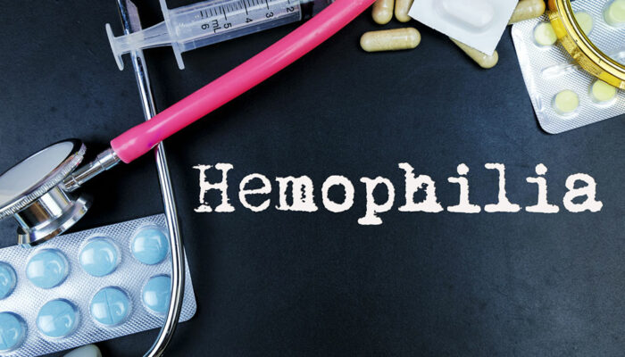 6 common treatment options for hemophilia