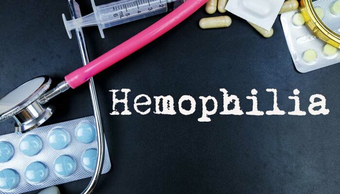 7 Common Ways to Treat Hemophilia