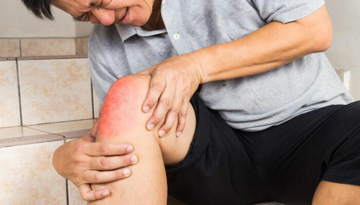 7 Effective Home Remedies for Quick Relief from Joint Pain