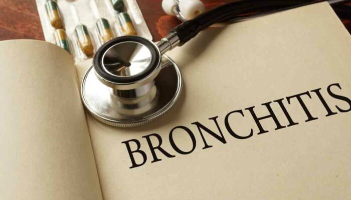 7 Methods for Treating Chronic Bronchitis