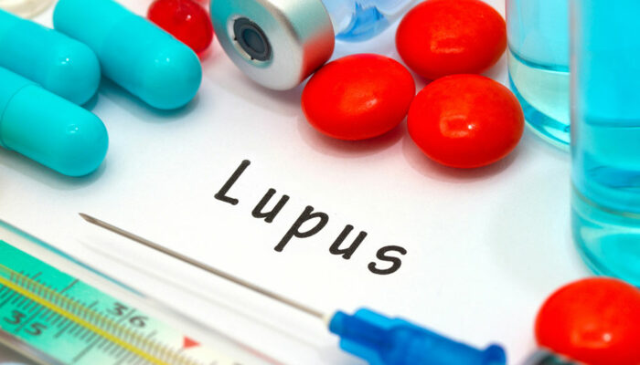 7 common symptoms of lupus