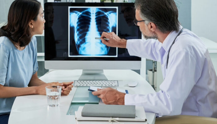 7 early symptoms of lung cancer