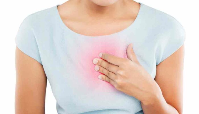 8 Effective Home Remedies for Heartburn