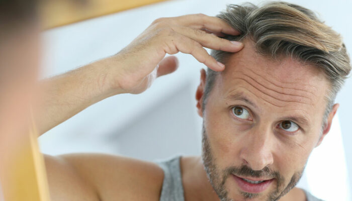 10 Effective Home Remedies to Stop Hair loss