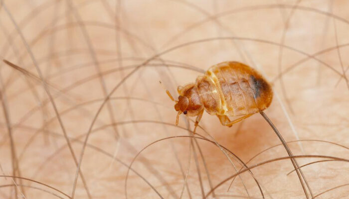 10 Home Remedies to Get Rid of Bed Bugs