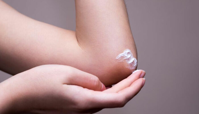 10 Popular Products to Get Relief from Eczema