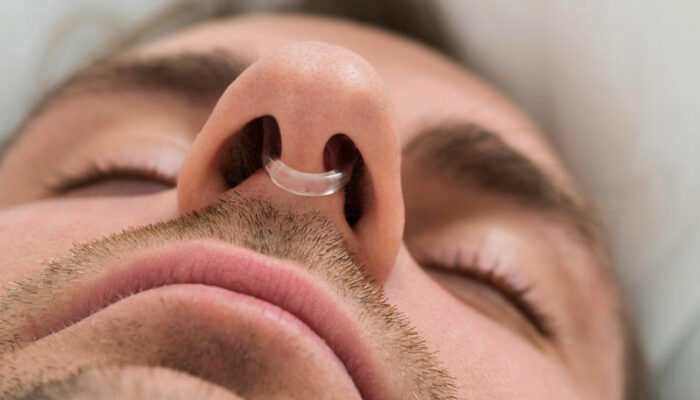 10 Things You Need to Know about Anti Snoring Devices