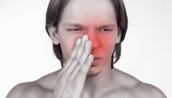 3 Steps to Get Effective Relief from Sinusitis