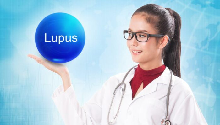 3 effective ways for living with lupus