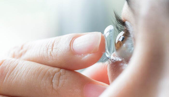 A Brief Overview Of Contact Lenses