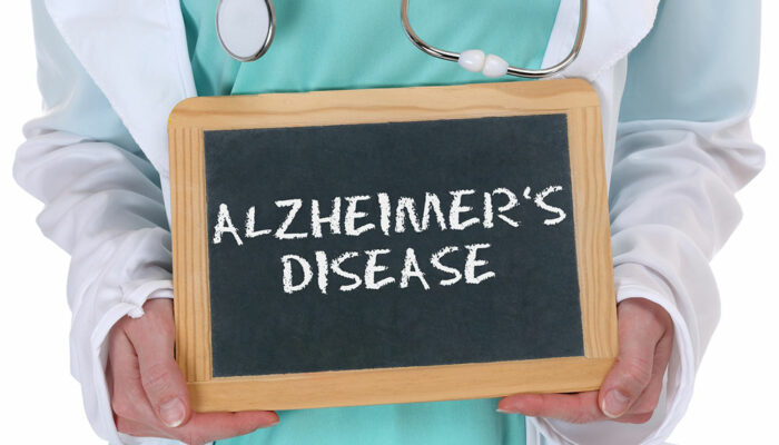 A comprehensive guide on Alzheimer’s disease