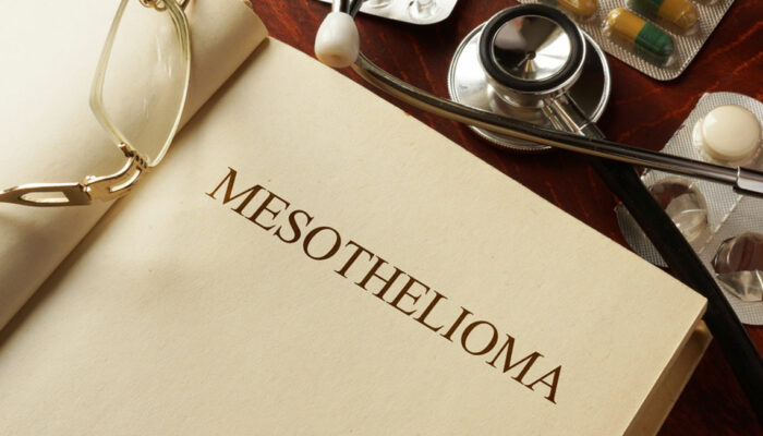 All you need to know about mesothelioma and its symptoms