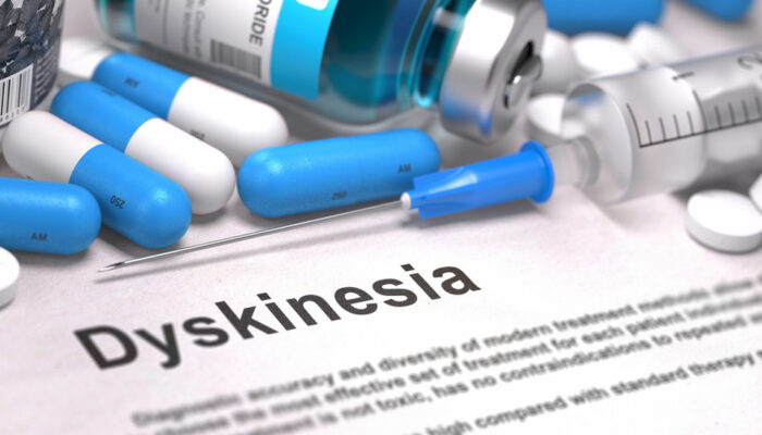 All You Need to Know About Tardive Dyskinesia