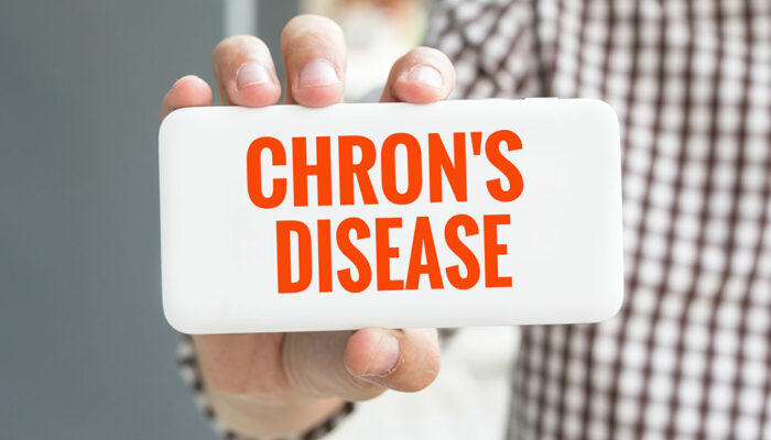 All You Need to Know about Chron&#8217;s disease