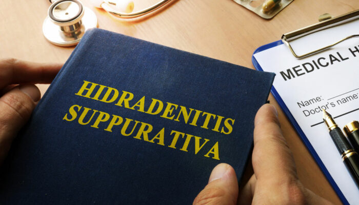 All You Need to Know about Hidradenitis Suppurativa