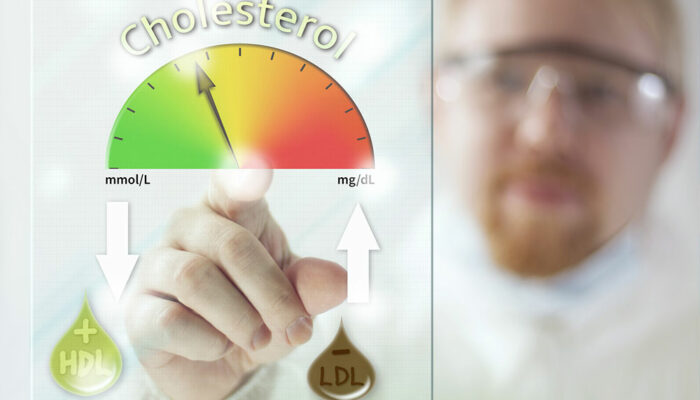 All You Need to Know about High Cholesterol Levels