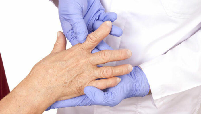 An Overview On Rheumatoid Arthritis