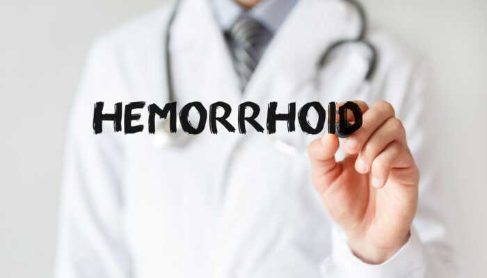 An Overview Of External Hemorrhoids- Causes, Symptoms, And Treatment