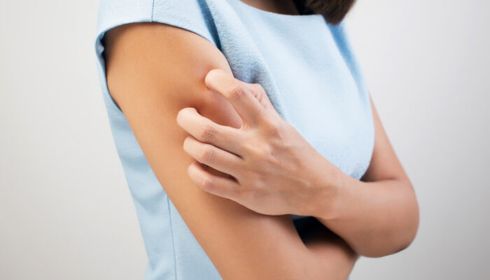 An Overview Of Skin Rashes And Its Treatment